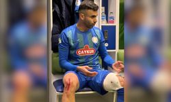 Rizespor, Ghezzal’ın ayağının fotoğrafını paylaştı