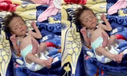 Gazze'de bebekler açlıkla mücadele ediyor: 6 kilo olması gereken bebek 1.5 kilo