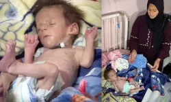 Gazzeli Yusuf bebek, 1.5 kiloyken hayatını kaybetti