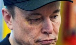 Elon Musk: Oğlum X gözüme yumruk attı, beklediğimden güçlüymüş